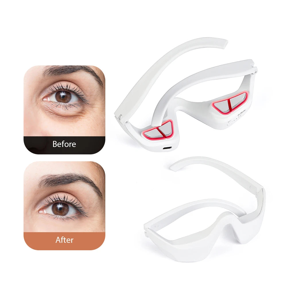3D Eye Massager - Fatigue Relief, Dark Circle Lightening & Fine Line Smoothing Eye Care