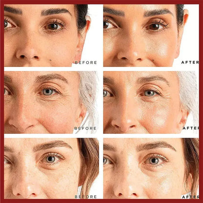 Retinol Wrinkle Remover Face Cream - Firming, Anti-Aging & Moisturizing Skin Care