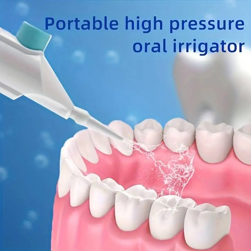 Portable High Pressure Oral Irrigator – Manual Water Dental Floss & Teeth Cleaner