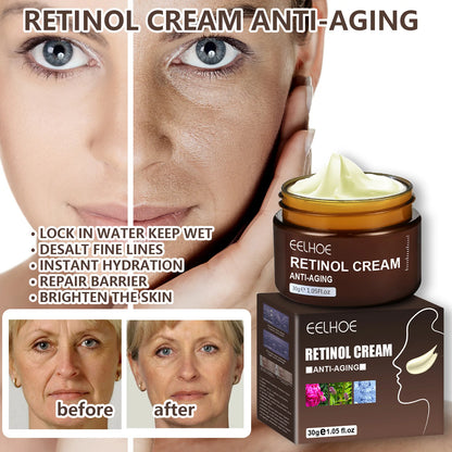 Retinol Wrinkle Remover Face Cream - Firming, Anti-Aging & Moisturizing Skin Care