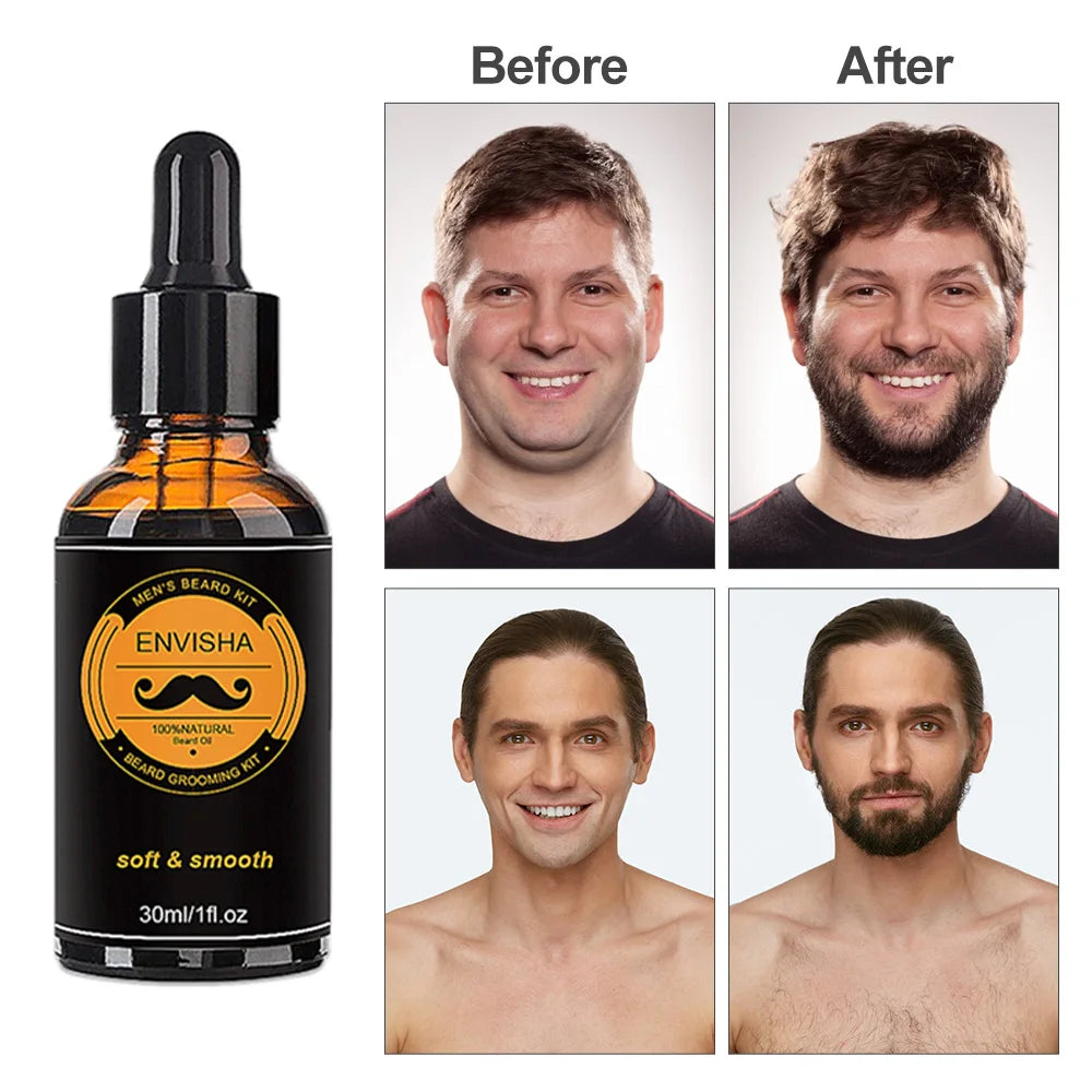 Beard Growth Kit for Men - Essential Oil, Moisturizing Wax, Growth Roller, Comb, and Styling Scissors for Beard Care